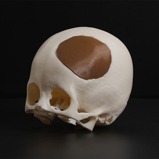 3D Print Skull model with a brown patch on a black background made from PEEK Filament by INTAMSYS